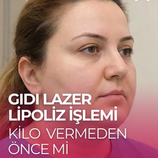 Gıdı lazer lipoliz kilo vermeden önce mi sonra mı yapılmalı?

En ideali, kilo vermeden önce gıdı laz