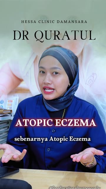 ATOPIC ECZEMA

Anak nampak aktif, tapi kulit masih belum pulih? 😔

Atopic eczema bukan sekadar kuli