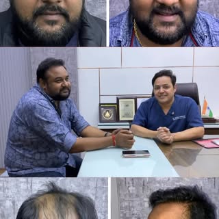 #HairTransplant
#HairTransplantJourney
#HairTransplantExperience

#BeforeAfterTransformation
#Confid