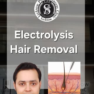 ✨ Laser Hair Removal से भी कुछ बाल रह गए हैं?

White Hair? Grey Hair? Scattered Hair? Sparse Hair Gr