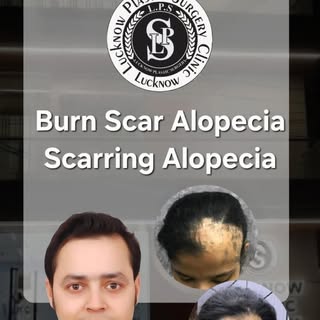 Restoring Confidence Beyond Borders ✨
Advanced Hair Restoration & Reconstructive Plastic Surgery by 