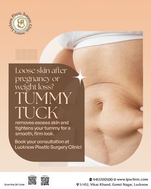 Update 2026✨ TUMMY TUCK – Restore Your Shape, Renew Your Confidence ✨

Loose abdominal skin, stubbor