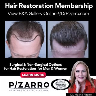 💥NEW Per Area Pricing for #hairrestorationsurgery for Men & Woman
with Dr. Marina Pizarro, 35 Years