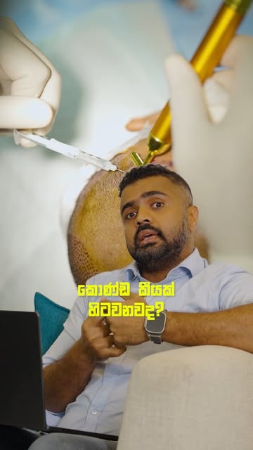 Hair Transplant එක මුලින් හොඳට පෙනුණත්… අවුරුදු කිහිපයකින් ඒ result එක වෙනස් වෙන්න පුළුවන්. 👀🌱

Lo