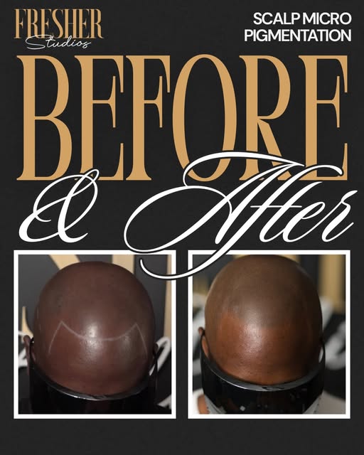 A great SMP result is not “one shade fits all.” It’s designed—specifically—for YOUR skin tone, under