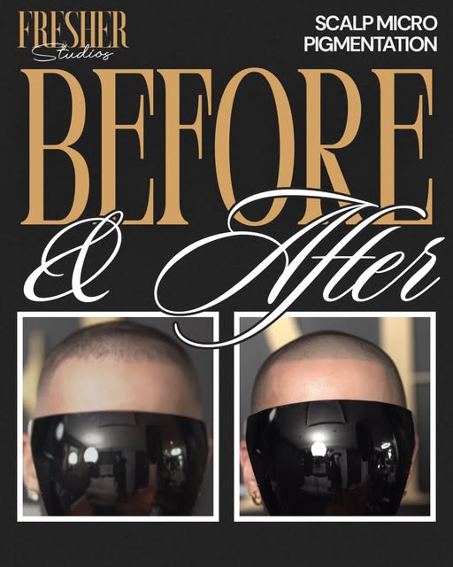 When you’re a barber, you see hairlines every day. And when yours keeps moving back, it hits differe