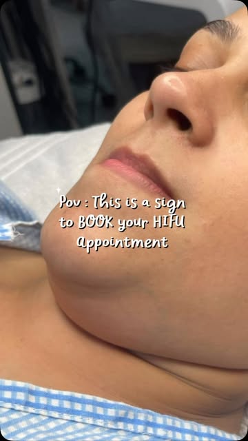 HIFU TREATMENT ✨

A non-surgical treatment that helps improve skin firmness and gives a more lifted,
