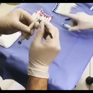 Cilt ve Saç yapısına uygun olarak saç ekimi işlemi yapılmalıdır ekilen saç kökleri yüzde 95 kalem te