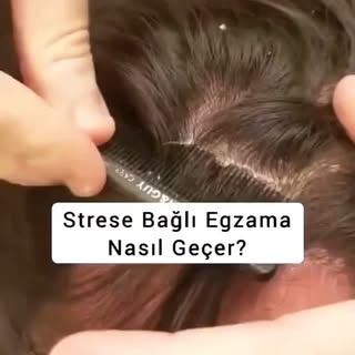 EGZAMA, Cildin koruyucu bariyerinin zayıflaması sonucu ortaya çıkan ; genellikle kuruluk, şiddetli k
