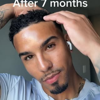 7 months ago, I decided to invest in myself.

I wasn’t dealing with hair loss, but I noticed my hair