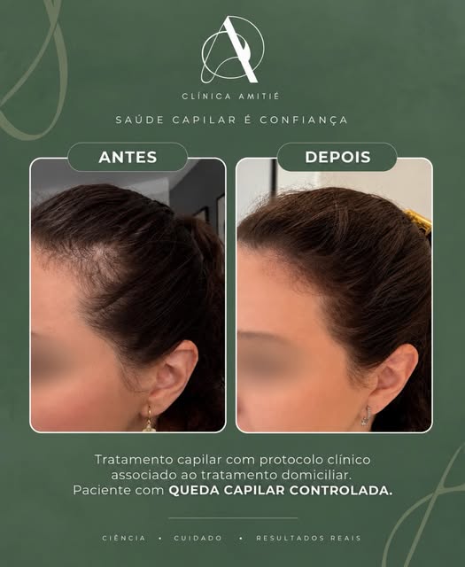 🌱 Resultados reais vêm de avaliação, estratégia e tratamento personalizado.
Cada detalhe do protoco
