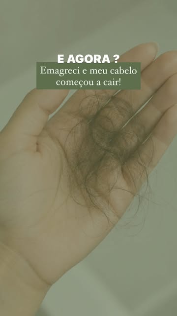 Emagrecer pode transformar o corpo, mas quando a perda de peso acontece de forma muito rápida, o cab