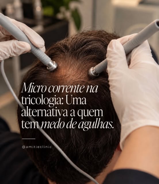 Tem medo de agulhas, mas quer cuidar da saúde dos seus fios? 🌱

A microcorrente pode ser uma altern