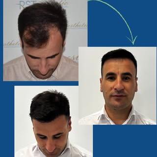 KOCAELİ/İZMİT

Kendiniz için bir iyilik yapıp hayalinizdeki saçlarınıza kavuşmak için bir adım atmay