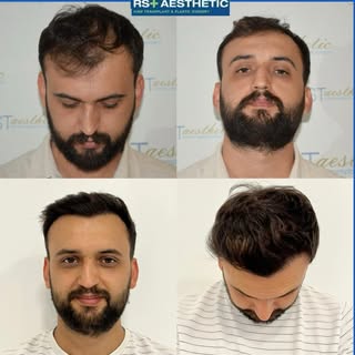 KOCAELİ/İZMİT

Kendiniz için bir iyilik yapıp hayalinizdeki saçlarınıza kavuşmak için bir adım atmay