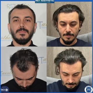 KOCAELİ/İZMİT

Kendiniz için bir iyilik yapıp hayalinizdeki saçlarınıza kavuşmak için bir adım atmay
