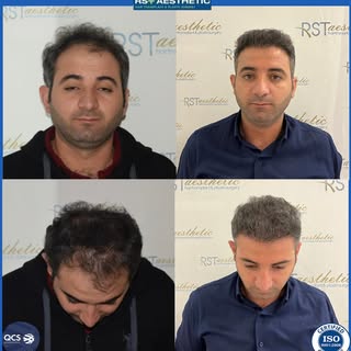 KOCAELİ/İZMİT

Kendiniz için bir iyilik yapıp hayalinizdeki saçlarınıza kavuşmak için bir adım atmay
