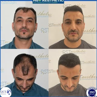 KOCAELİ/İZMİT

Kendiniz için bir iyilik yapıp hayalinizdeki saçlarınıza kavuşmak için bir adım atmay