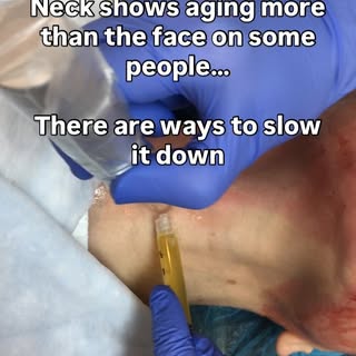 ✨ Don’t forget your neck! ✨
The neck is one of the first areas to show signs of aging—and it deserve