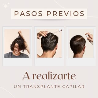✨ Prepararte para un trasplante capilar exitoso empieza mucho antes del procedimiento.

🔑 Aquí te c