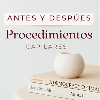 Nada como ver los resultados reales de un trasplante capilar para entender su impacto.
✔️ Antes: ins