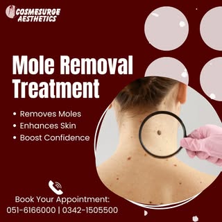 🌹Smooth, even skin starts with Mole Removal
⏰Book Your Appointment Now: 
☎️0516166000
📱0342 150550