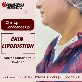 ✨Eliminate chin fat, enhance your look. Don't let a double chin hold you back.
⏰Book Your Consultati