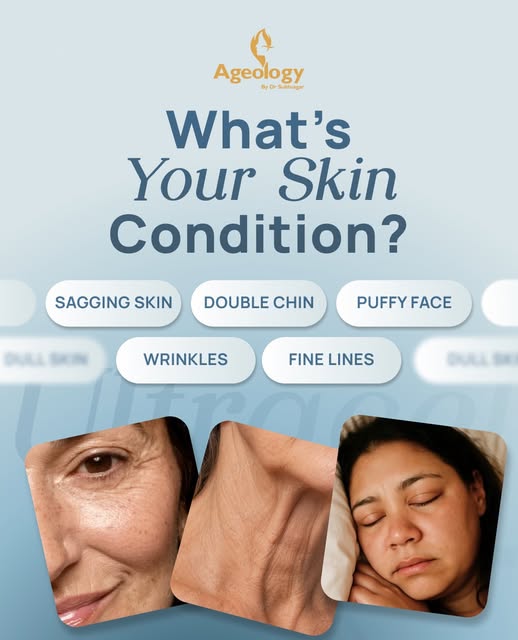 Whether it’s sagging skin, a double chin, or fine lines, meet ULTRACEL Q+ an advanced, non-surgical 
