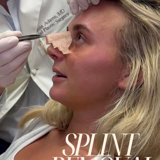 One week later ✨ There’s nothing like seeing the excitement after splint removal 🤍 Our sweet patien