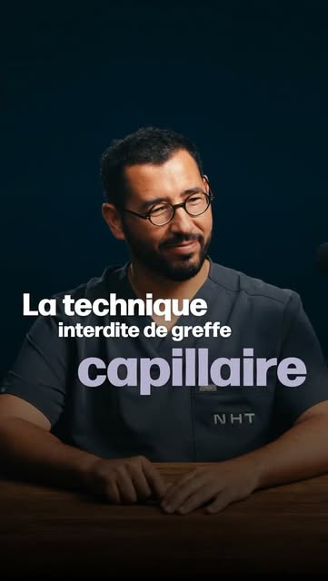 Il existe une technique de greffe capillaire que nous avons abandonnée depuis plus de 15 ans.

La FU