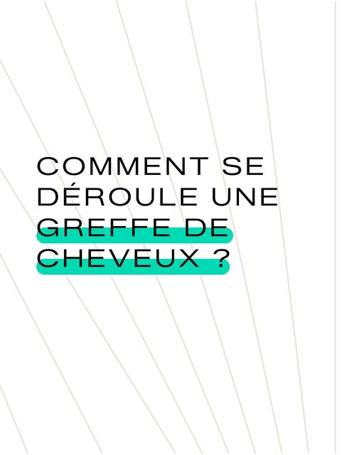 Comment se déroule une greffe de cheveux ? 👇

L’intervention se déroule en 4 grandes étapes :
💉 L’