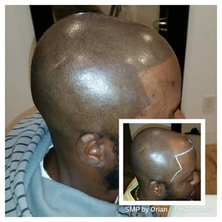 Giving my client a perfect line up!
#hairtattoo #headtattoo #hairlinetattoo #scalptattoo