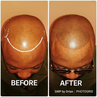 A failed treatment at the hands of a regular tattoo artist left the client unsatisfied.
I have been 