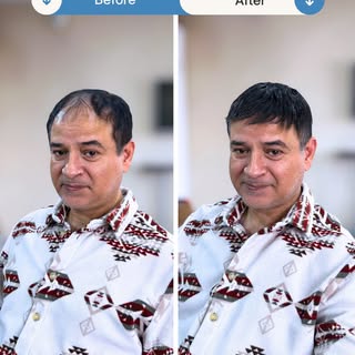 Sadece 3 saatte daha genç, gür ve karizmatik saçlar! 🔥 NeoHair Nanoteknoloji ile duşta, denizde, sp