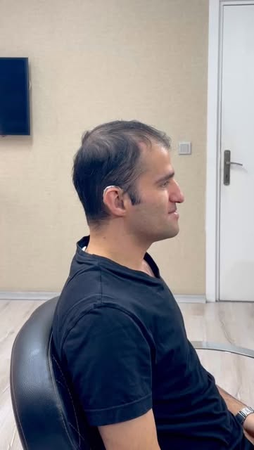 Seyrelme ve saç kaybı kaderiniz olmak zorunda değil. Neohair’in kişiye özel, tamamen doğal ve nefes 
