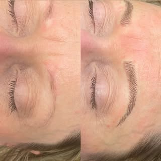 If Microblading is done properly it should look soft and natural. Also,it should fade overtime, so t