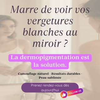 Vos vergetures blanches vous empêchent de vous sentir pleinement à l’aise dans votre peau ?

Avec la