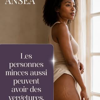 Les personnes minces aussi peuvent avoir des vergetures.

Pourtant, beaucoup pensent encore que les 