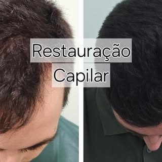 Imagens que falam por si
A restauração capilar devolve mais do que cabelo: devolve autoconfiança, ju