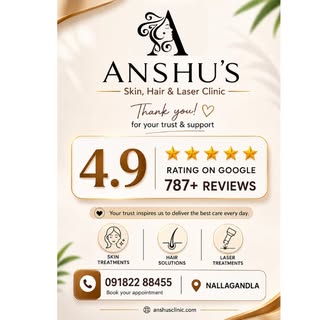 🌟 A Milestone We’re Proud Of! 🌟

With an incredible ⭐ 4.9 Rating and 787+ Google Reviews, Anshu's 