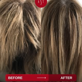 Struggling with hair issues? 

With 20 years of expertise and UK Board Certified Clinical Trichologi