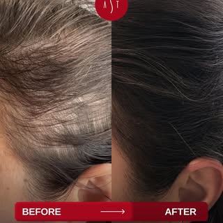 Struggling with hair issues? 

With 20 years of expertise and UK Board Certified Clinical Trichologi