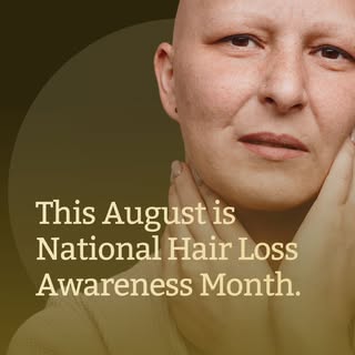 Struggling with alopecia and feeling like you've already tried everything? You're not alone.

For ma