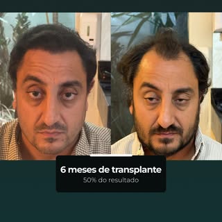 Com 6 meses, o resultado já mostra cerca de 50% da evolução esperada.
A tendência é de mais ganho de
