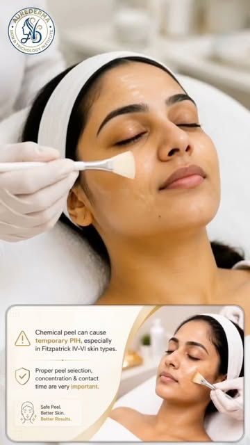 🧴 Chemical Peel – Pre-Peel & Post-Peel Care Instructions

✨ Before the Chemical Peel | Pre-Care

• 