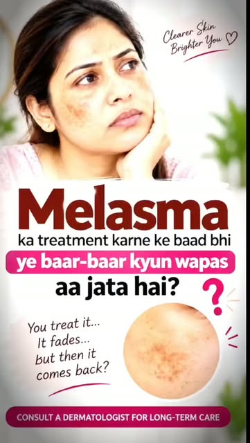 Why does melasma keep coming back even after treatment? 🤔

Melasma is more than just a pigmentation