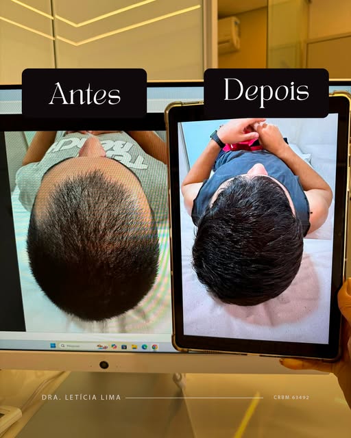 Dia de relembrar este incrível resultado, que é o que acontece quando o tratamento é feito do jeito 