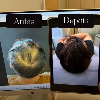Resultados reais exigem os cuidados certos. ✨

Confira a diferença no antes e depois, após o nosso p