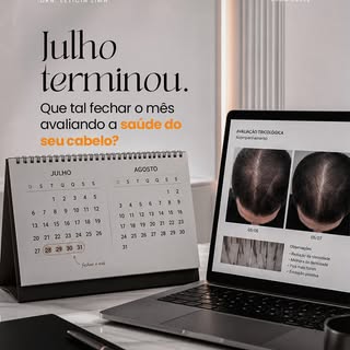 Fechar o mês é um bom momento para revisar também a saúde capilar. Vale observar se a queda de cabel