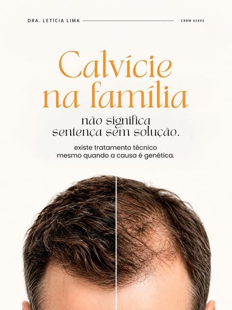 Muita gente acredita que, se o pai ou o avô teve calvície, não existe mais nada a fazer. Esse é um d